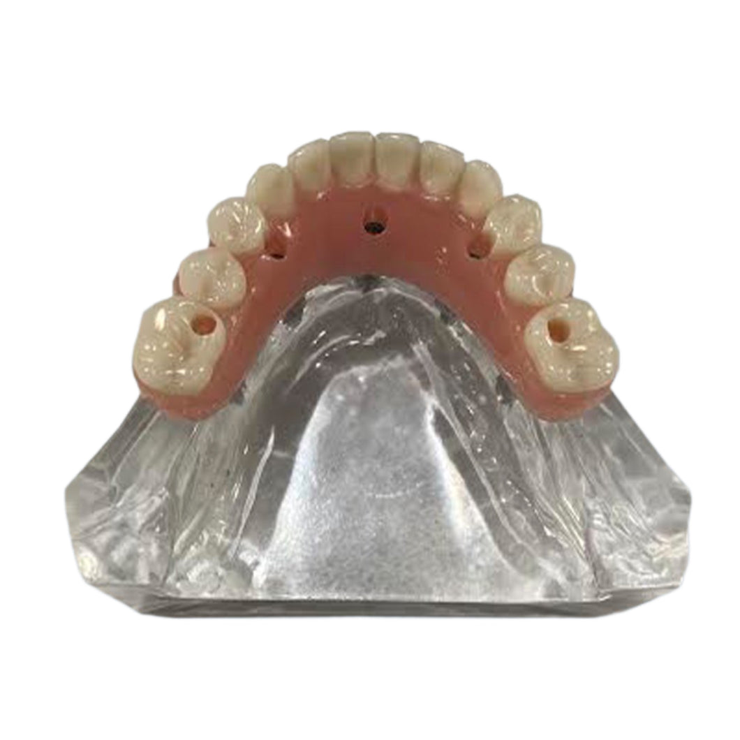 All on 5 Maxillary Demo Model