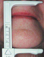 Load image into Gallery viewer, Knebelman Craniometer
